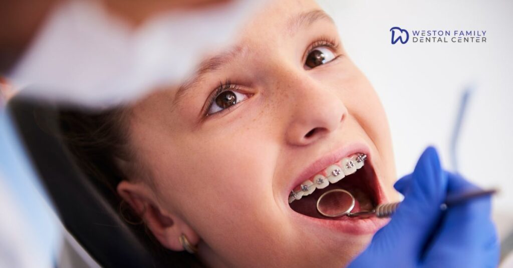Braces for Kids and Adults in Weston: When Is the Right Time to Start?
