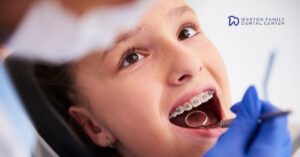 Braces for Kids and Adults in Weston: When Is the Right Time to Start?