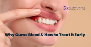 Why Are My Gums Bleeding? Causes & Treatment Guide