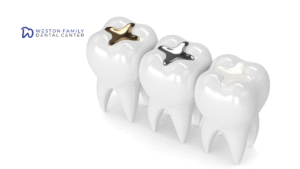 Composite tooth filling