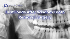 Best Foods After Wisdom Tooth Removal Surgery