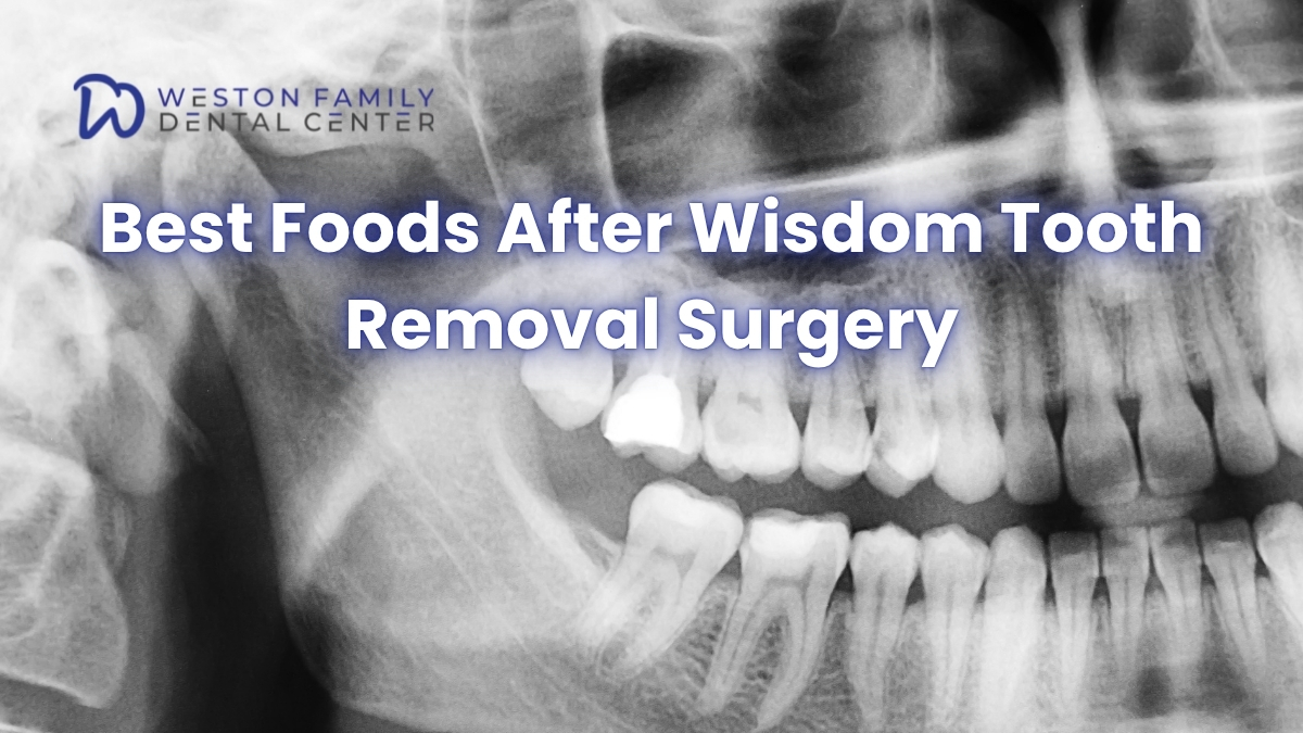 Best Foods After Wisdom Tooth Removal Surgery
