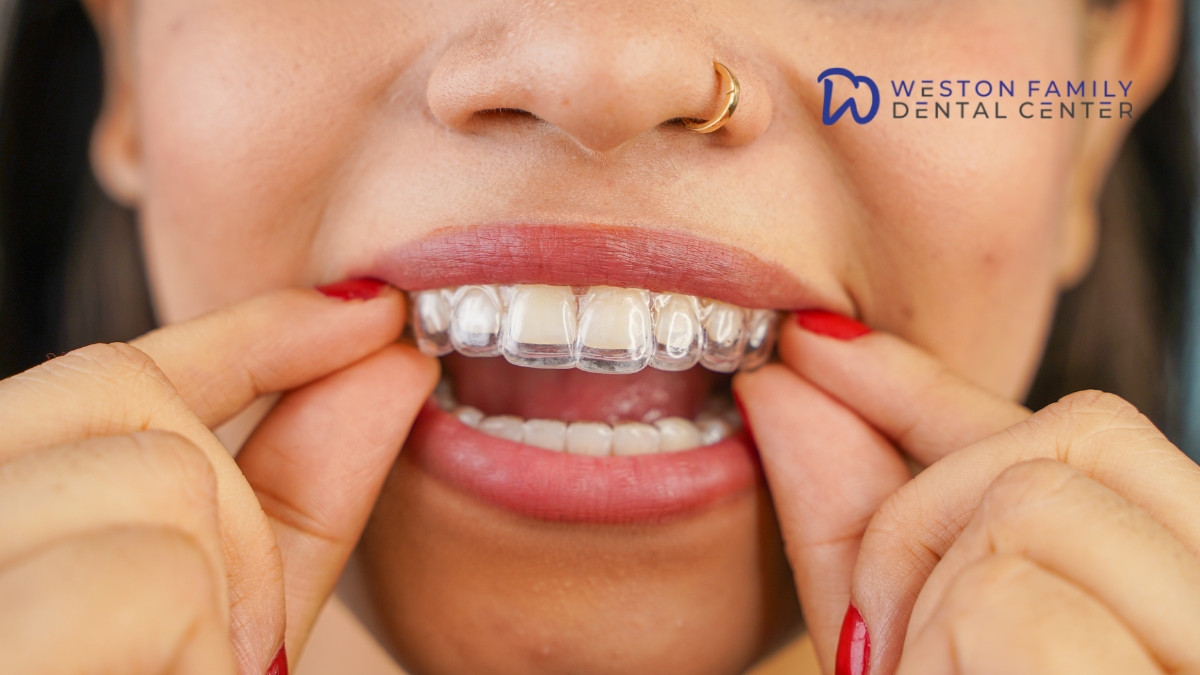 Powerful Invisalign Benefits for Busy Adults