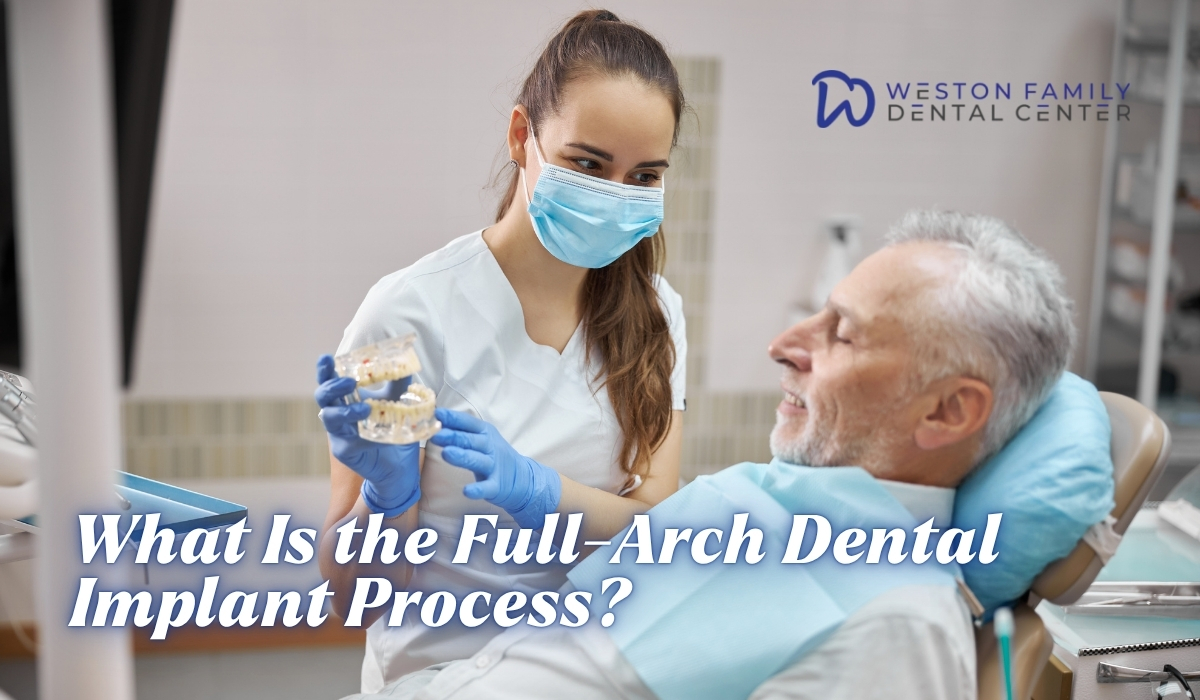 What Is the Full-Arch Dental Implant Process?