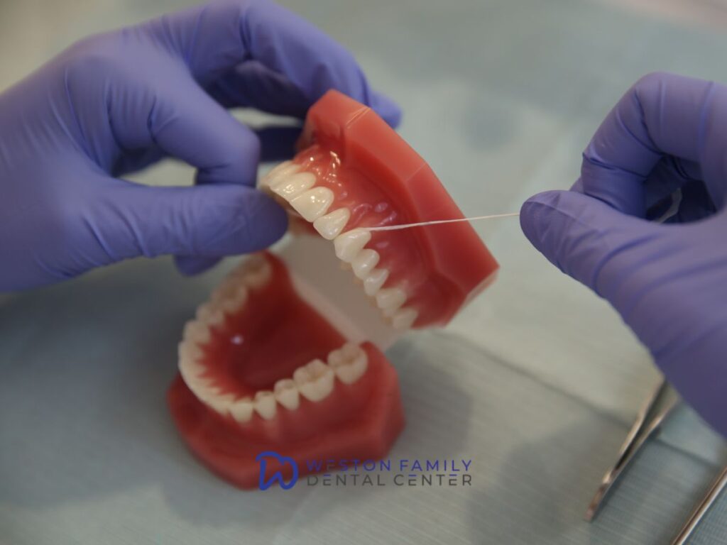 How Long Do Full-Arch Dental Implants Last A Guide for Weston Patients