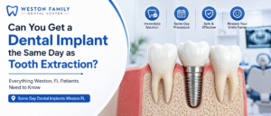 Same day dental implants Weston FL after tooth extraction