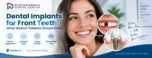 Dental implants for front teeth in Weston FL with a natural looking smile and custom implant crown