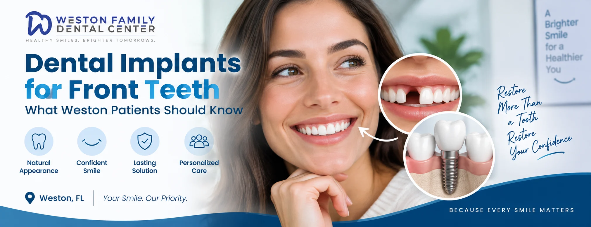 Dental implants for front teeth in Weston FL with a natural looking smile and custom implant crown