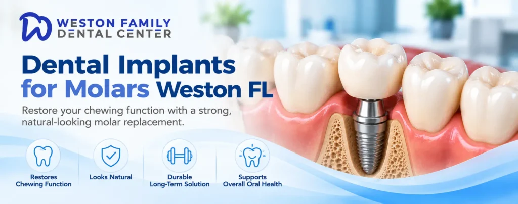 Dental implant replacing a missing molar in Weston FL
