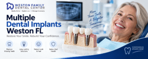 image showing of Multiple Dental Implants Weston FL: 7 Things to Know