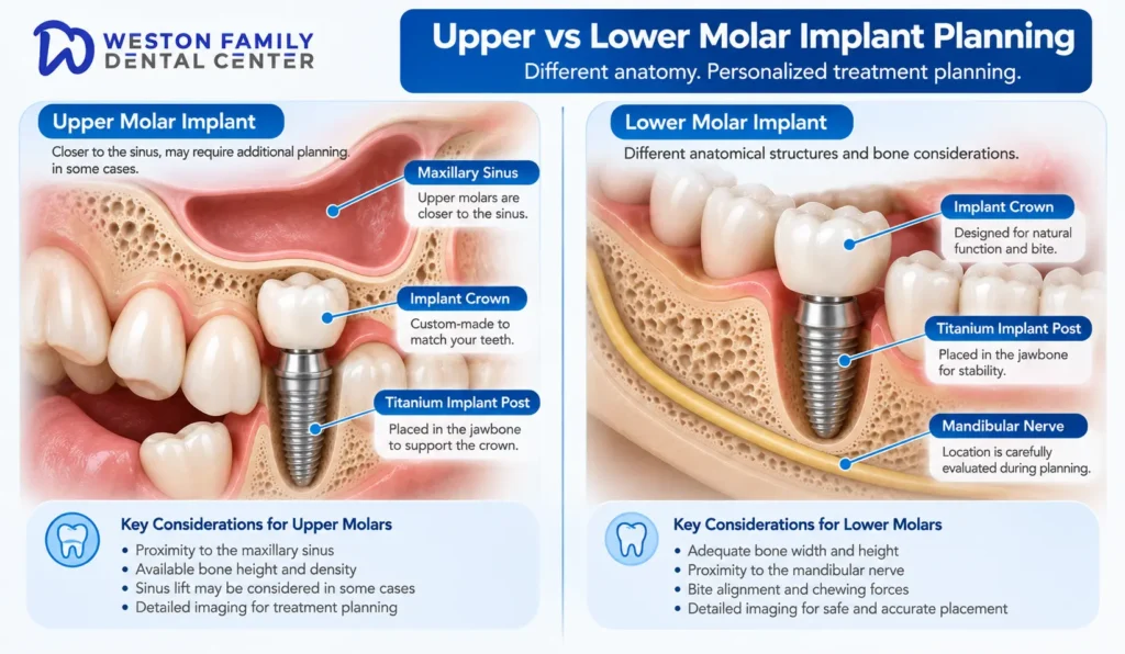 Comparison of upper and lower molar dental implant anatomy
